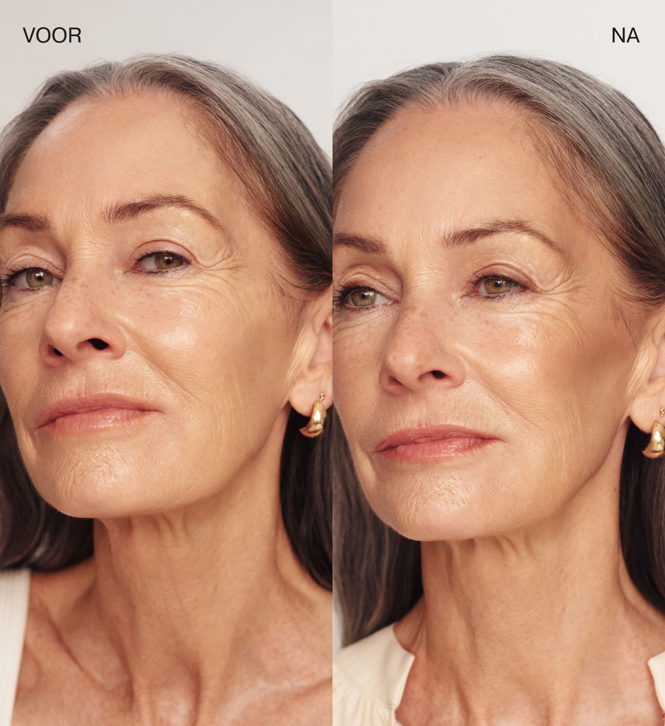 The Valentines Bundle met The Soft Tan Bronzer voor en na vergelijking die een natuurlijke zomerse gloed laat zien